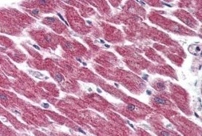Immunohistochemistry-Paraffin: GPR116 Antibody [NBP3-14341]